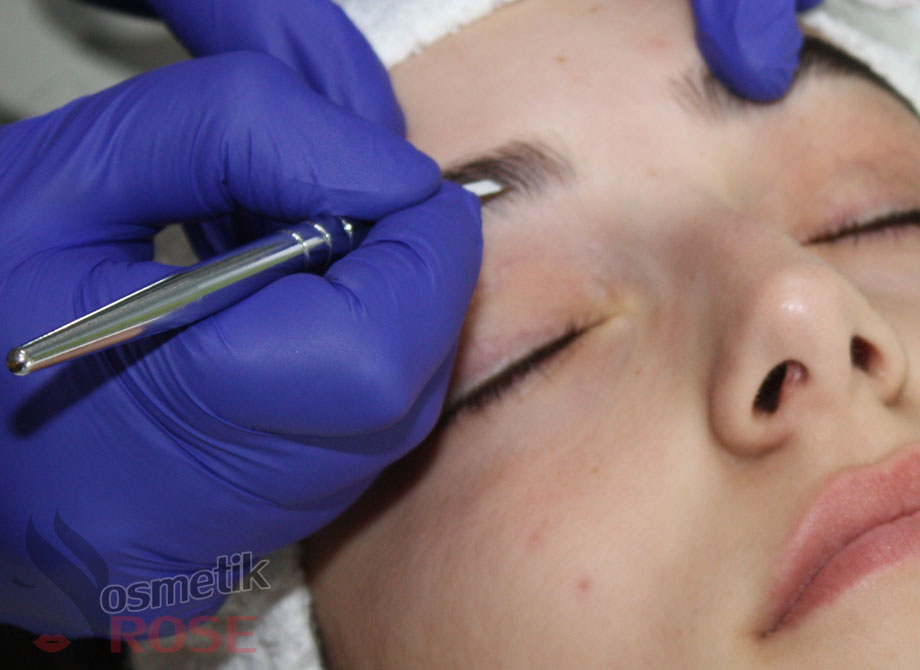 Microblading