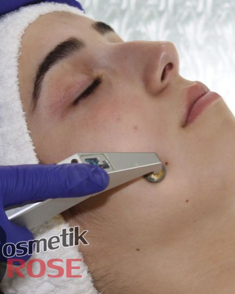 OXYjet Suaerstoffbehandlung