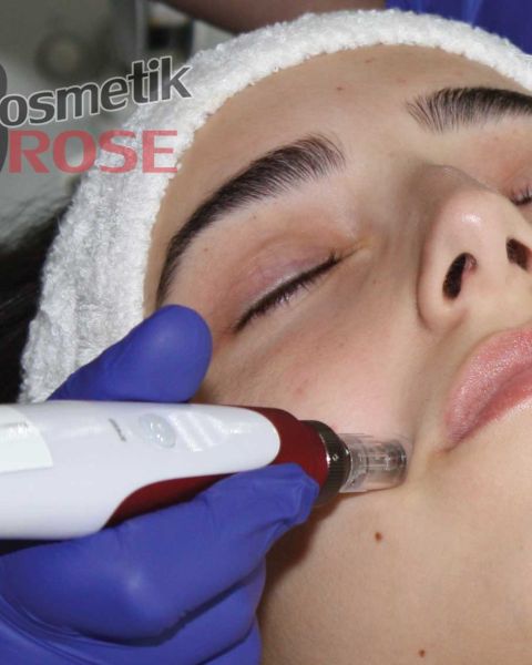 Micro Needling